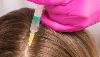 موارد منع انجام مزوتراپی مو چیست؟