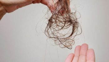 آیا بوتاکس مو عوارضی دارد؟