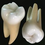 کاشت دندان طبیعی